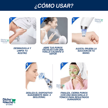 SUCCIONADOR DE PUNTOS NEGROS