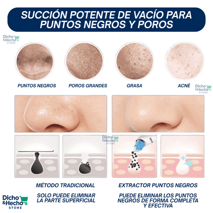 SUCCIONADOR DE PUNTOS NEGROS