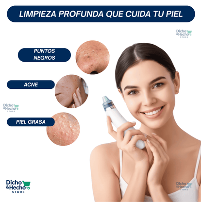SUCCIONADOR DE PUNTOS NEGROS